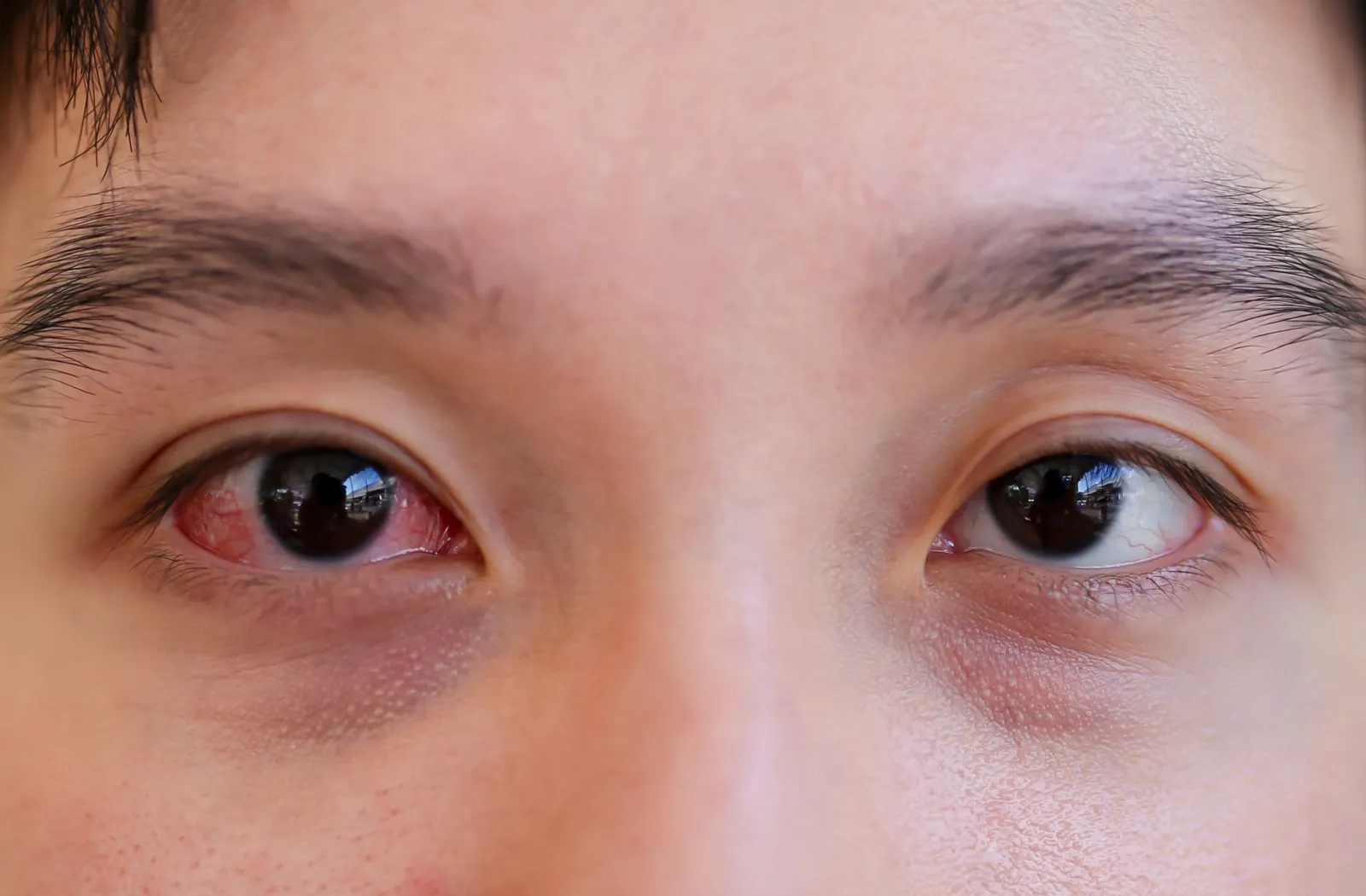 Common Eye Problems and Their Treatment A Guide for All Ages